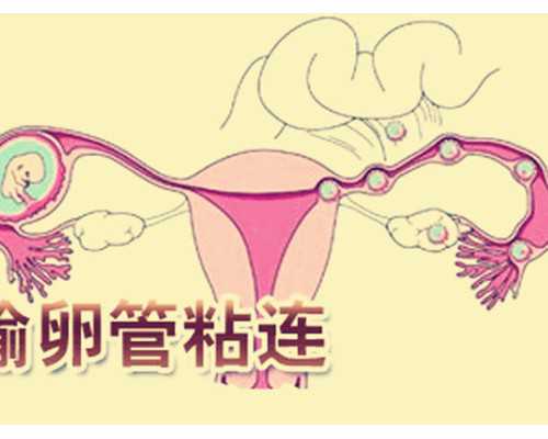 国内供卵哪里有卵源,女闭经了可以在广州做试管成功怀孕吗！如何合理规划！