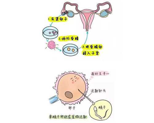 国内代怀怎么联系,你知道女性雌激素偏低身体会发出哪些信号吗